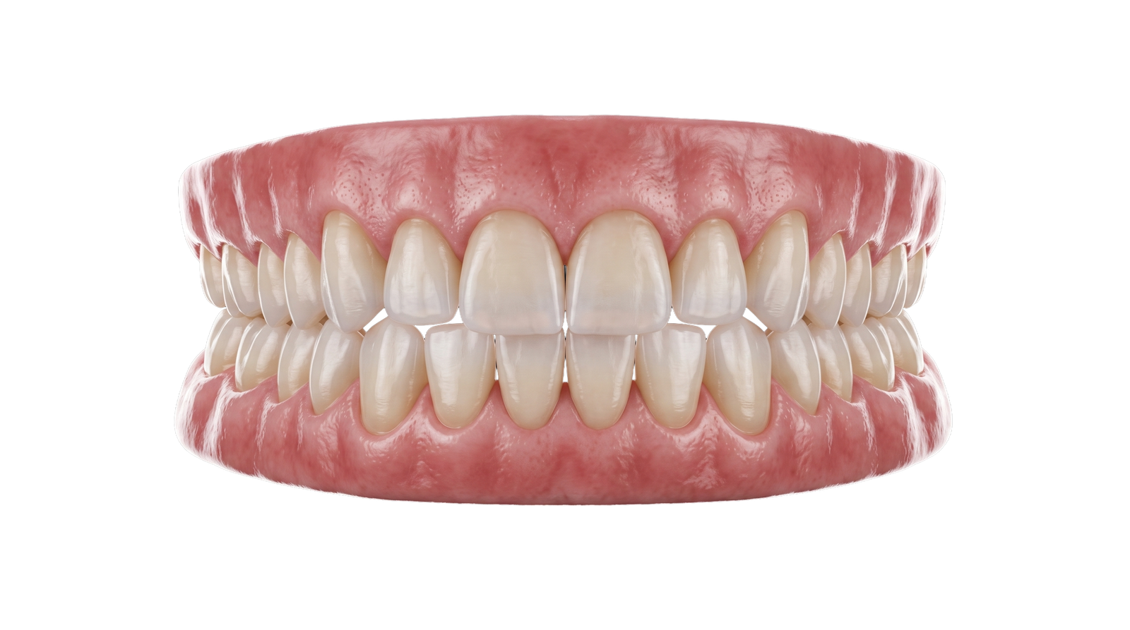 Diseño digital de sonrisa en 3D